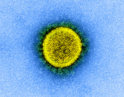 Electron scanning image of SARS-CoV-2